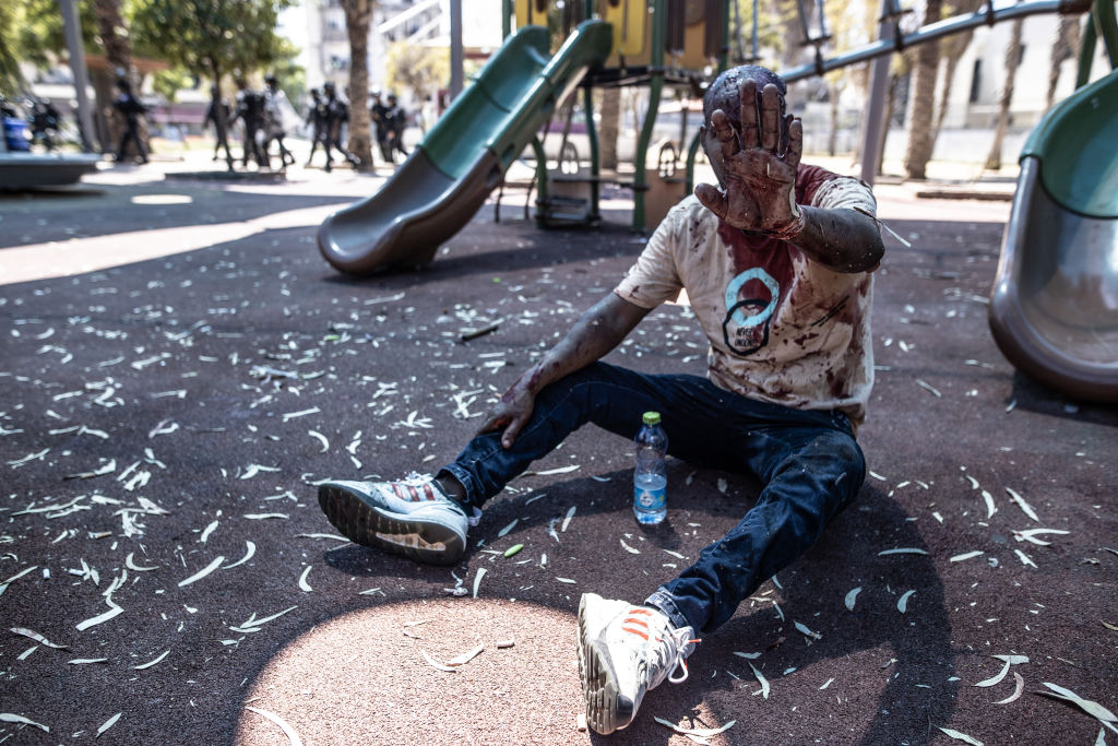 أحد المتظاهرين الإيرتيريين الذين تعرضوا للضرب في تل أبيب - Mustafa Alkharouf/A Getty Images