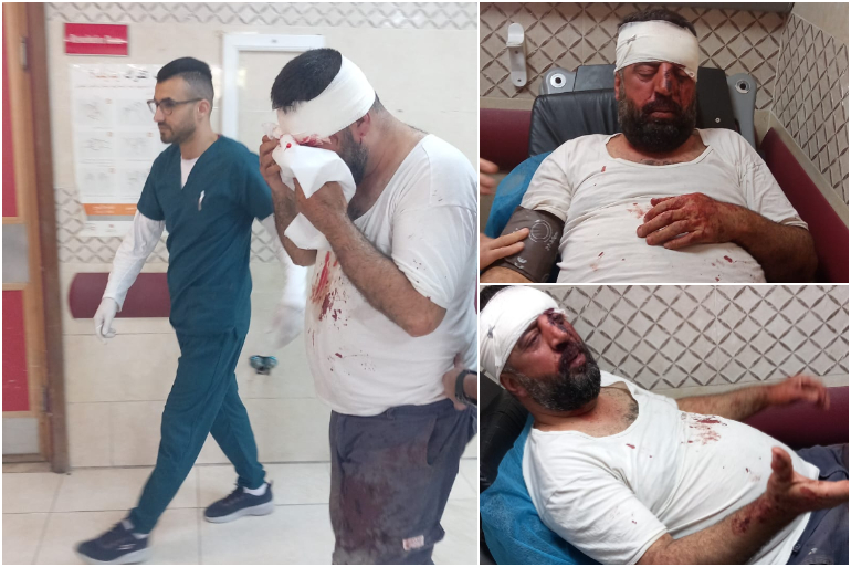 الشيخ خالد صلاح في مستشفى رفيديا بعد أن هاجمه مستوطنون