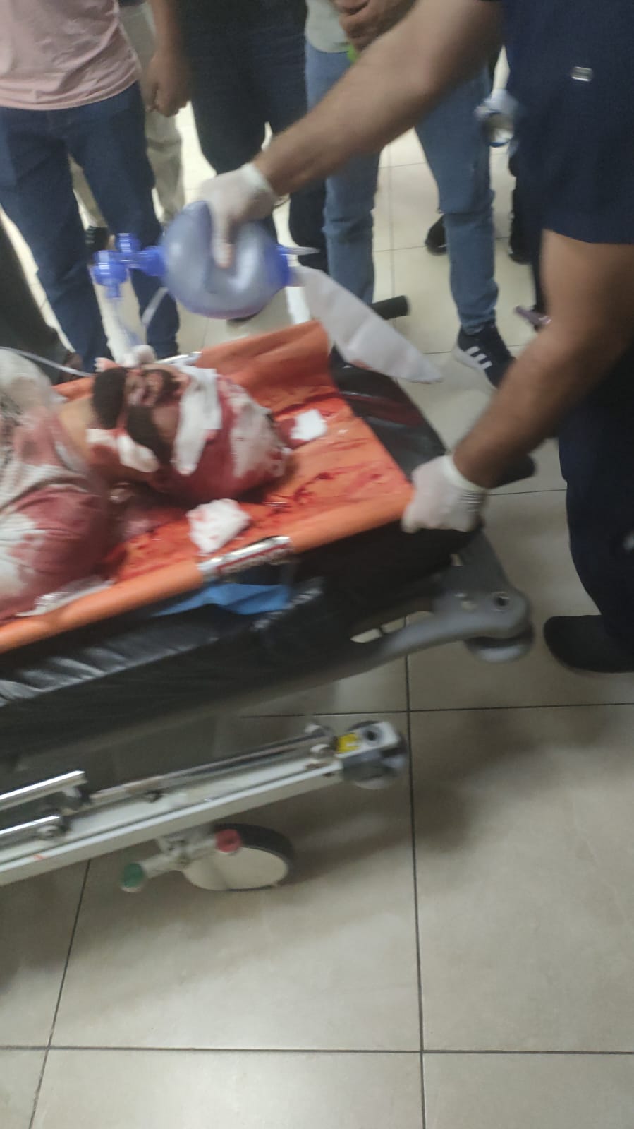 عميد بني شمسه داخل المستشفى بعد إصابته
