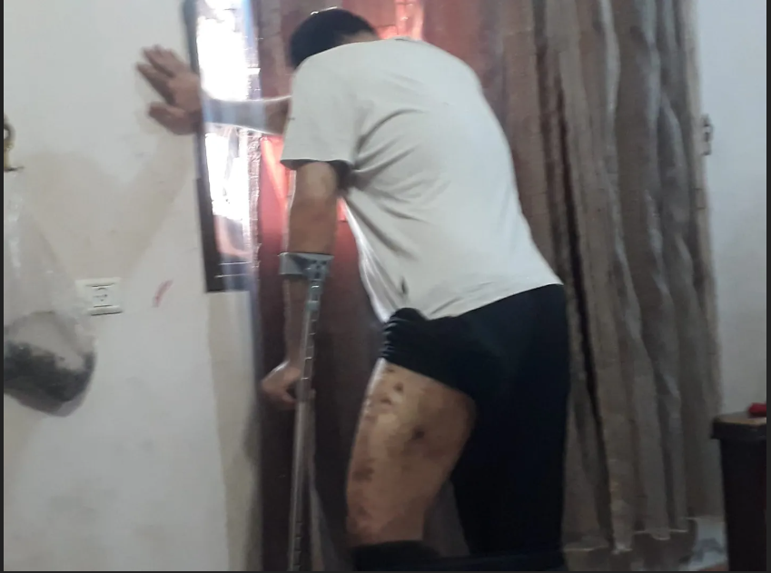 بعد أن أيقن الفلسطيني (ح) أنه لن يُسمح له بالسفر للعلاج، حدد موعدًا في غزة لبتر ساقه