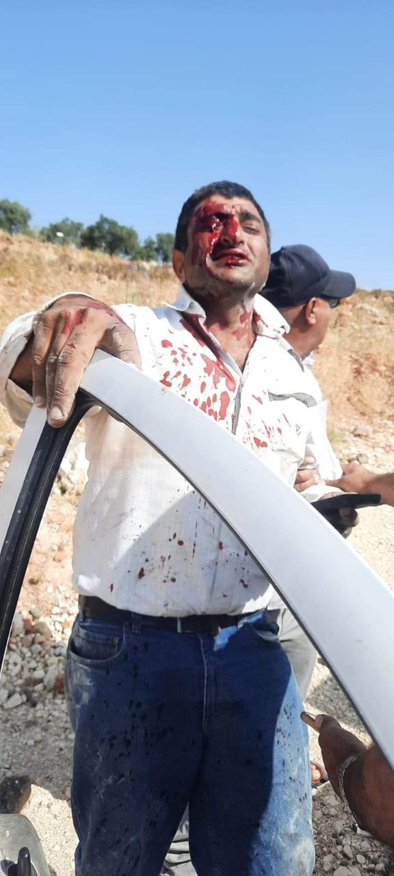 أحد من تعرّضوا لاعتداءات المستوطنين شرق رام الله، نهار السبت
