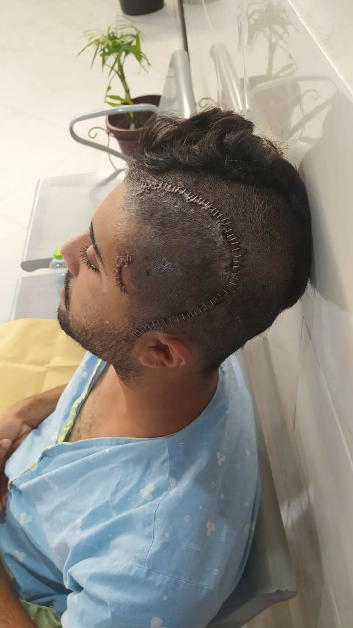 الصياد نافذ رمضان، بعد مكوثه في المستشفى على إثر إصابته برصاص بحرية الاحتلال