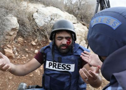 لحظة إصابة الصحفي معاذ عمارنة برصاص الاحتلال في عينه منتصف نوفمبر 2019 -  HAZEM BADER/Getty Images