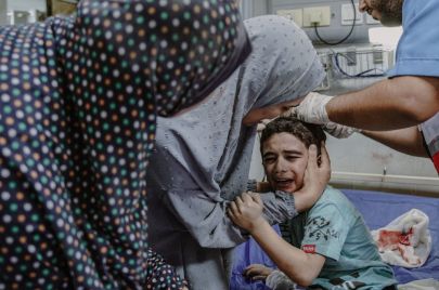 طفل مصاب في غارة إسرائيلية في 13 أكتوبر 2023